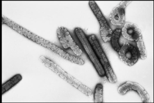 What’s Happening Now: Marburg Virus in Ethiopia